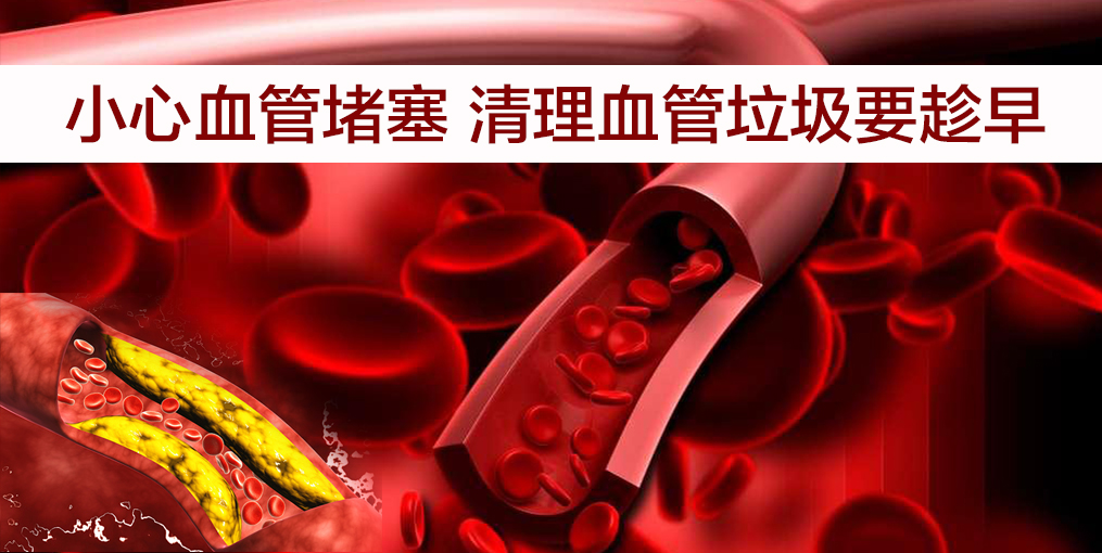 當(dāng)心！這幾類人群血管最易堵，適當(dāng)補(bǔ)硒遠(yuǎn)離血管疾病