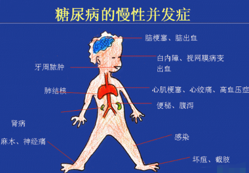 你還在害怕高血糖嗎？科學(xué)補(bǔ)硒不“恐糖”