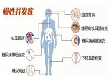 遠離高血糖并發(fā)癥，請記住一點，學會“補硒”