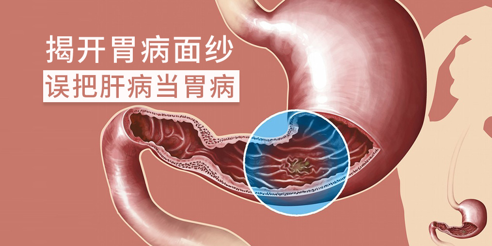 警惕“假胃病”，小心是肝有問(wèn)題