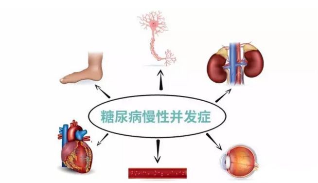 血糖波動(dòng)大，并發(fā)癥來得快，糖友要多補(bǔ)硒